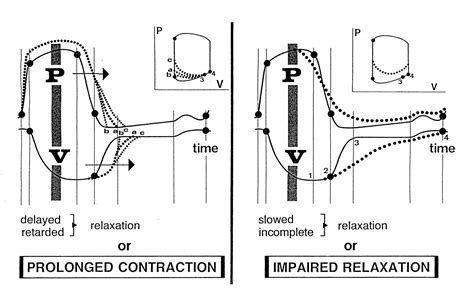 impaired lv relaxation treatment.